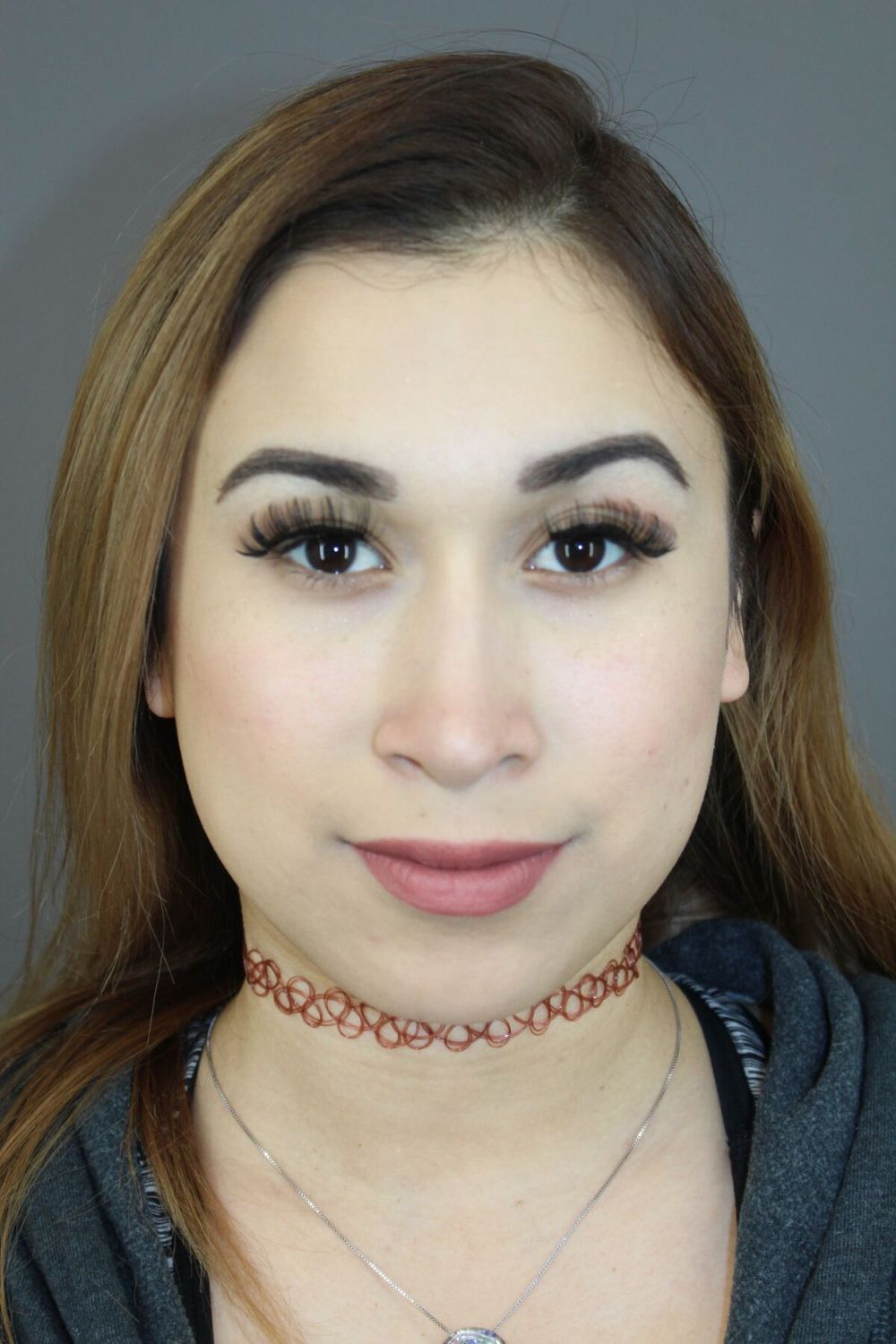 Rhinoplasty Before & After