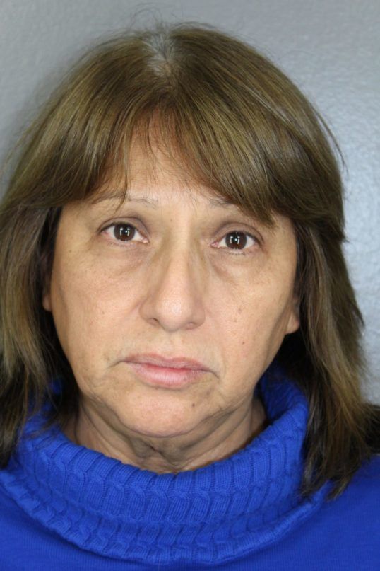 Rhinoplasty Before & After