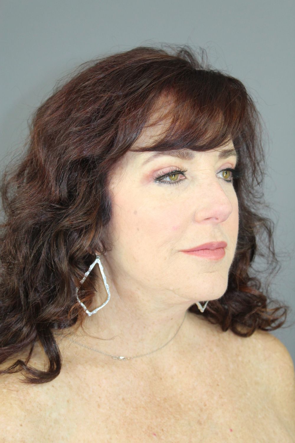 Face Lift Before & After